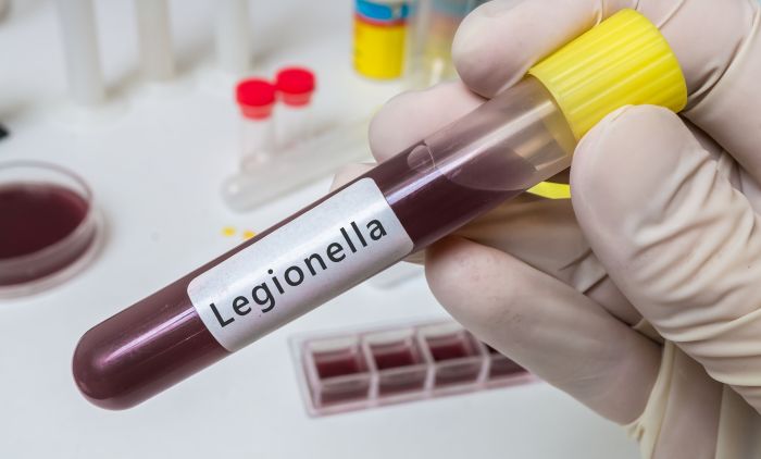 Корона се није ни завршила, стиже НОВО УПОЗОРЕЊЕ: Вреба нас ЛЕГИОНАРСКА БОЛЕСТ!